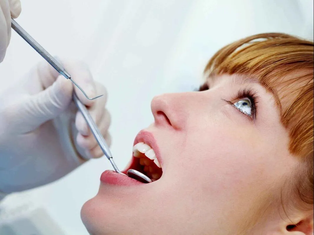 Dentalhygiene vor dem Bleaching