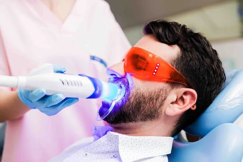 Bleaching-Behandlung mit Lichtaktivierung