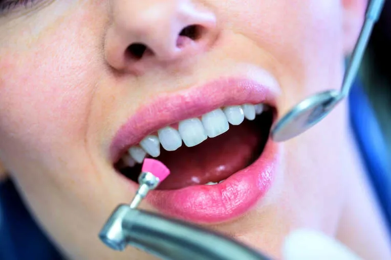 Nahaufnahme einer Dentalhygiene-Behandlung