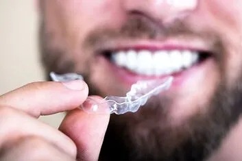 Person setzt eine transparente Zahnschiene ein