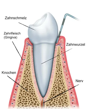 Schemazeichnung eines gesunden Zahns